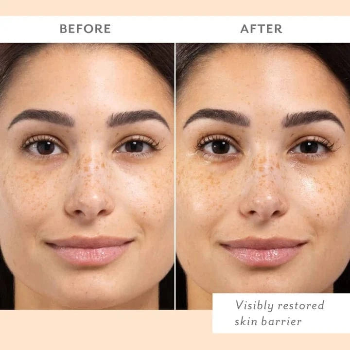 Patchology Gifts Skin Remedy Barrier-Boosting Sheet Mask