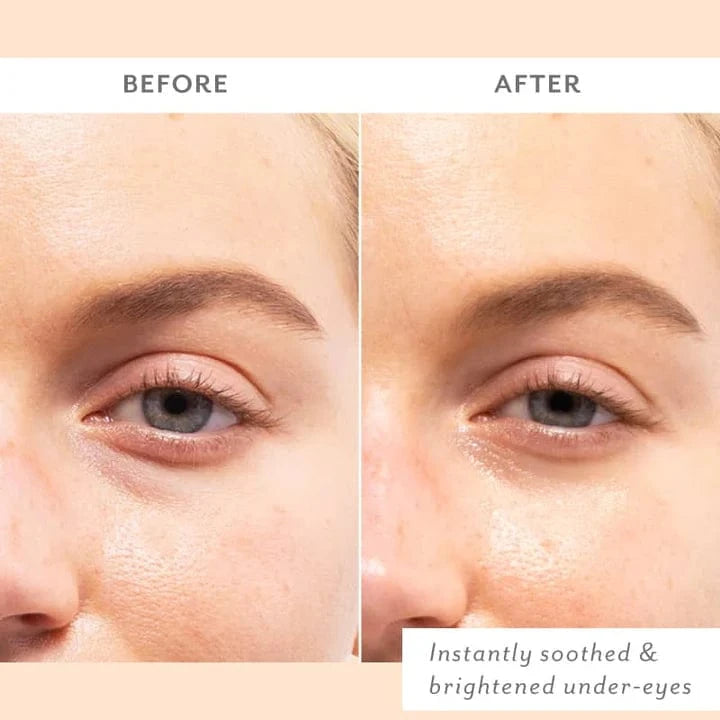 Patchology Gifts Skin Remedy Soothing Eye Gels